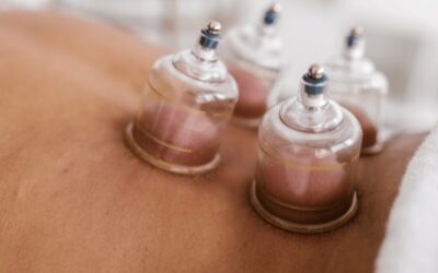 What’s dry cupping therapy ? what are the main benefits of this treatment?