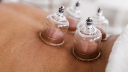 dry cupping therapy benefits