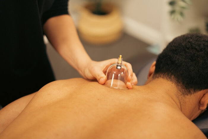 Dry Cupping Therapy service