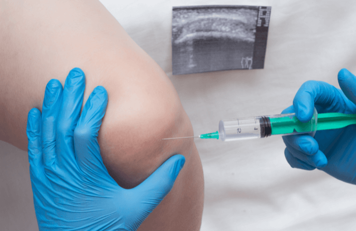 how long does cortisone injections last 